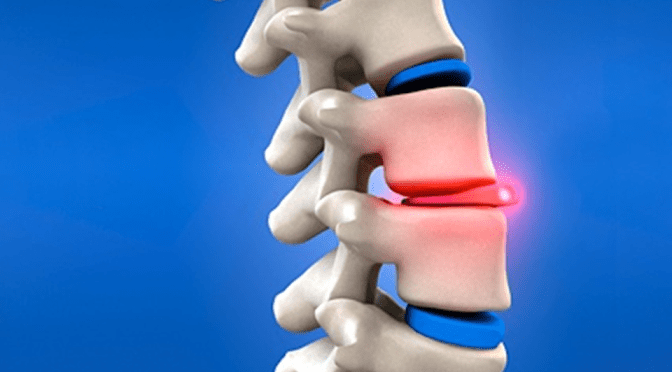 Back Instantly Healed