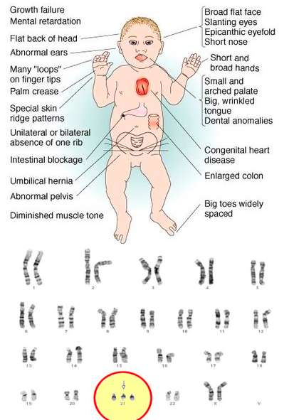 Down syndrome Mbah Dukun bagong 2